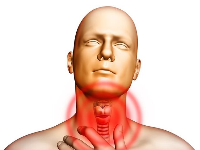 Sore throat due to parasites