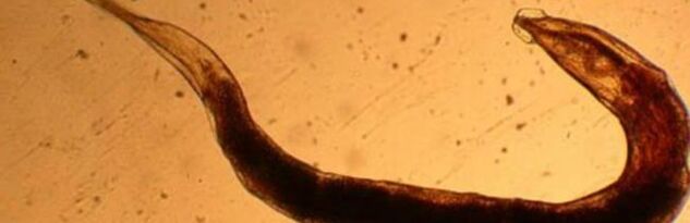 parasites from the human body