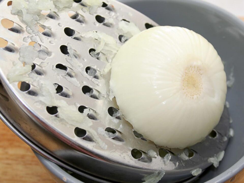 Mashed onions can expel parasites from the human body