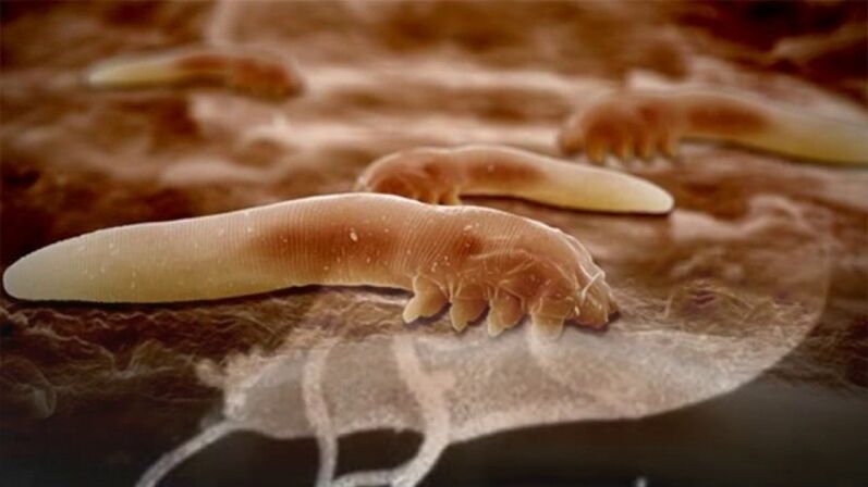 Parasitic