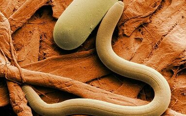 Causes of worms in humans