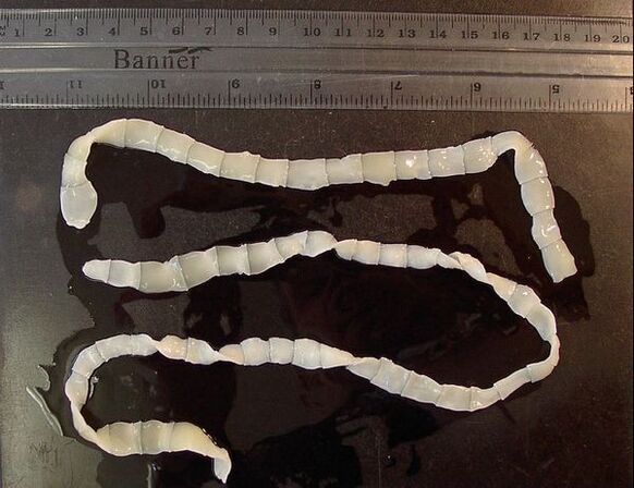 Broad tapeworms from the human body