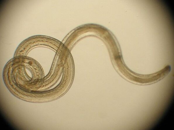 Trichinella is a parasite in humans