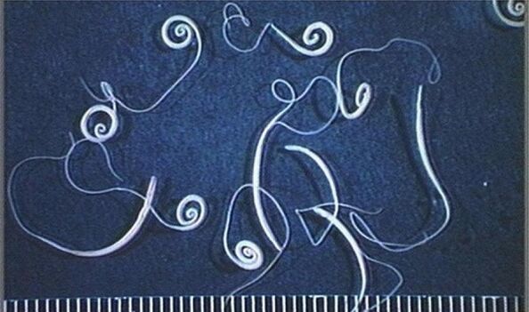 roundworms from the human body