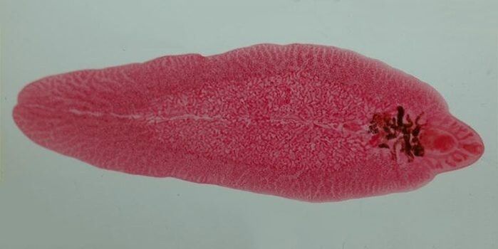 helminths in humans