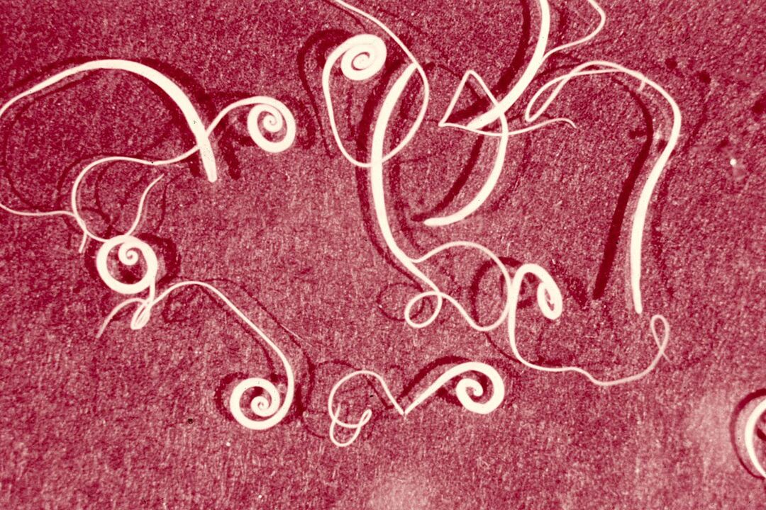 trichinella worm in humans
